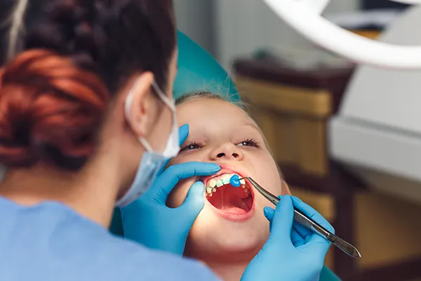 Young patient keeping their mouth open while the dental assistant applies fluoride in Chicago