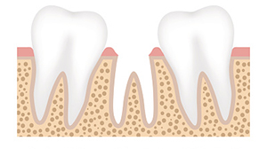 Rendering of a missing tooth between two healthy teeth at East Village Dental Centre