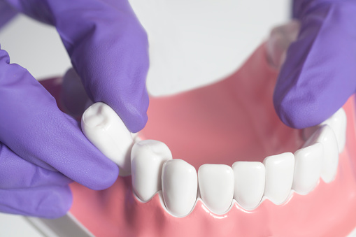 What Is The Tooth Extraction Post-Op Care?