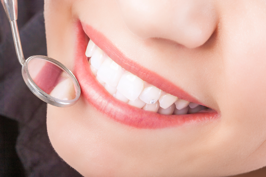 Common Myths About Dental Sealants